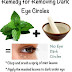 Natural treatment & home remedies to cure dark circles