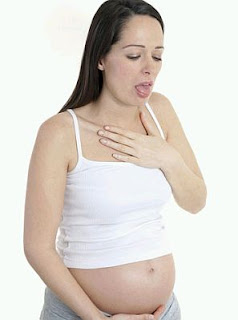 Embarazo, Ardores o Pirosis, Síntomas y Tratamiento