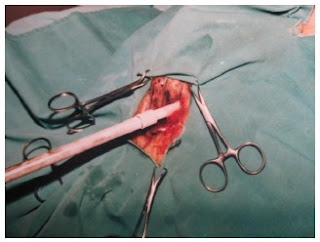 Teknik Operasi Perianal Fistula dan Fistula Rectovaginalis pada Hewan (Bedah Digesti)