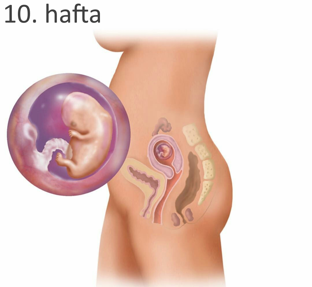 Симптомы 10 недели. Плод 9-10 недель беременности. Плод на 9 неделе беременности.