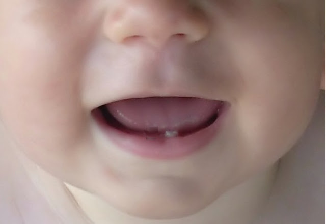 Begini yang Harus Dilakukan Untuk Merawat Gigi Susu Bayi