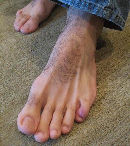 молоткообразный палец стопы. ступни стоят. пальцы ног у мужчин. пятки. здоровые мужские ноги.