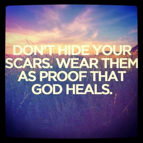 DONT HIDE YOUR SCARS WEAR THEM AS PROOF THAT GOD HEALS Quotes