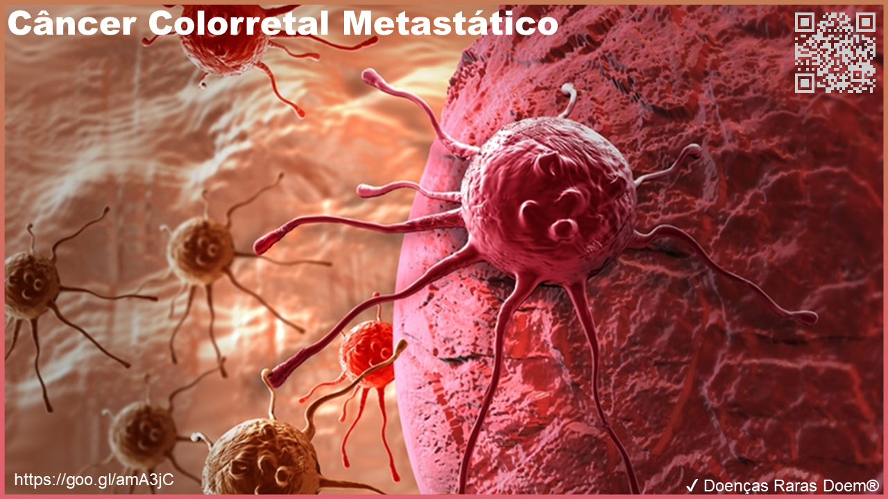 cancer metastatico