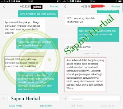 Cara Mengobati Kista Baker Secara Alami Tanpa Operasi Cara Mengobati Kista Baker Secara Alami Tanpa Operasi