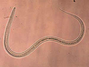 Blog FUAD - Informasi Dikongsi Bersama: Some Nasty Parasites Found In