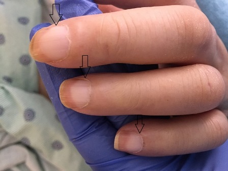 テリーの爪はどのように処理されていますか?