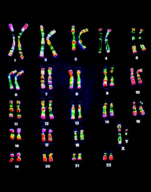 Kromosom pada manusia