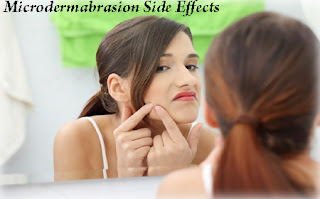 Skin Care: Skin Care - Microdermabrasion Side Effects