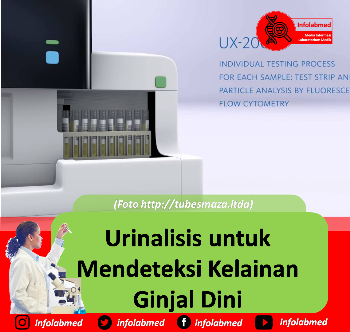 Urinalisis untuk Mendeteksi Kelainan Ginjal Dini