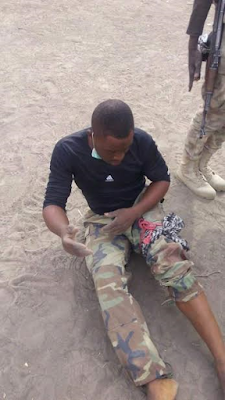 Photos: Nigerian Soldier shot in the leg during gun battle with Boko Haram in neighbouring Cameroon