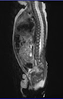 infant MRI