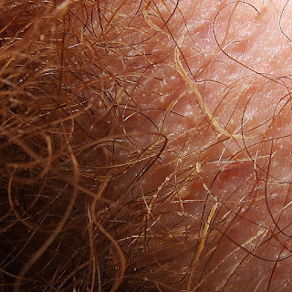 pubic hair vagina axillaris exercises enhancement male armpit brown grey coloured hygiene