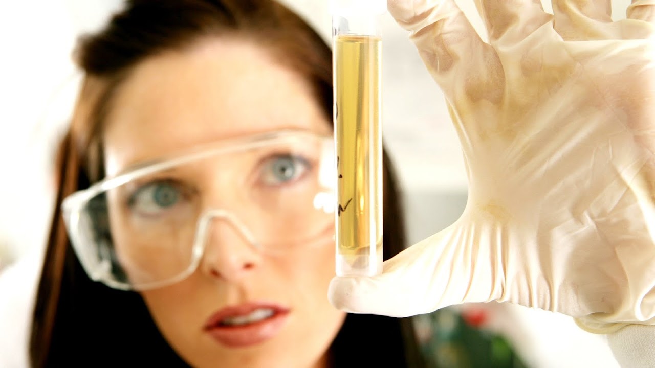 Trimethylaminuria Fish Test Urine Fish Choices