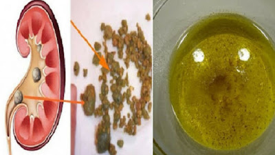 kidney