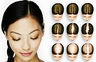Proses Hasil dari Biotin Suplemen Penumbuh Rambut Cepat Proses Hasil dari Biotin Suplemen Penumbuh Rambut Cepat