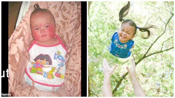 Heartwarming adoption story of Pinay kid born without limbs goes viral