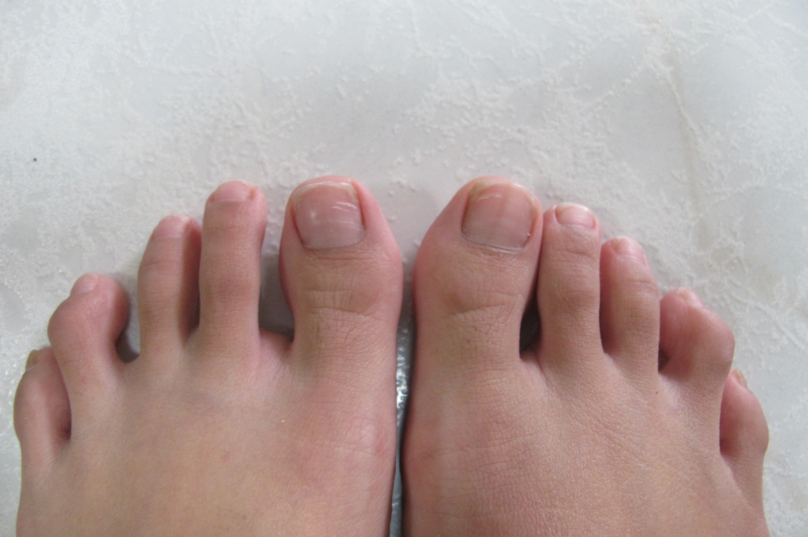 How to cure brittle nails