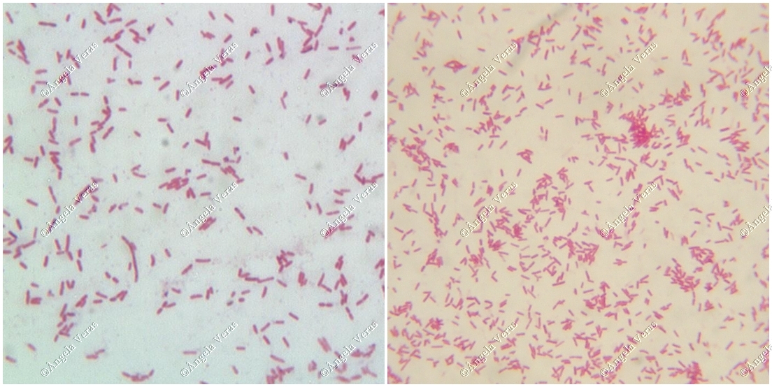 LFN321 Aulas Prática 4 e 5 Bactérias gram positiva