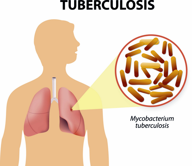 Non Pharmacology Tuberculosis Disease