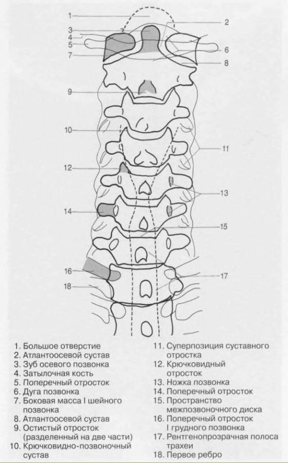 Задняя прямая мышца головы. 1 и 2 позвонок шейного отдела. Остистые отростки шейного отдела позвоночника. Ременная мышца шеи. Остистые отростки шейного отдела позвоночника.
