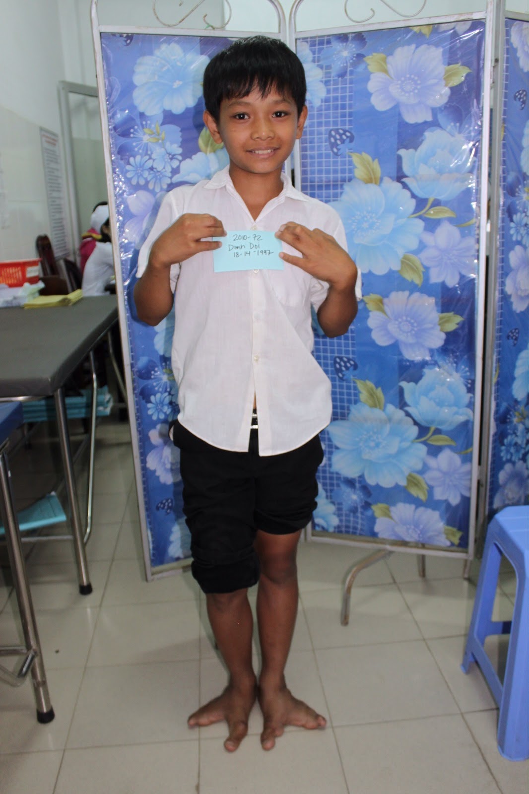 Memorable Case Ectrodactyly