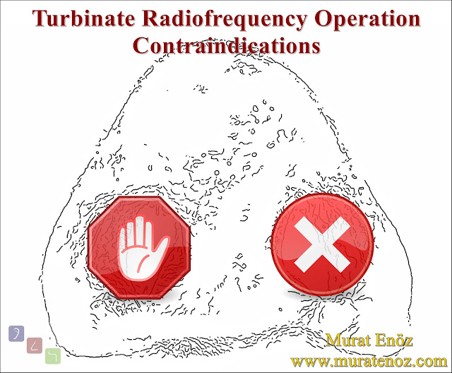 Radiofrequency Turbinate Reduction Contraindications - Radiofrequency Turbinate Reduction Risks - Turbinate Radiofrequency Risks - Turbinate Radiofrequency Complications