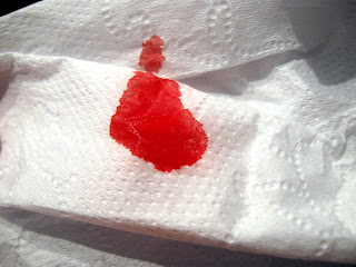 [Image: Blood+on+paper.JPG]