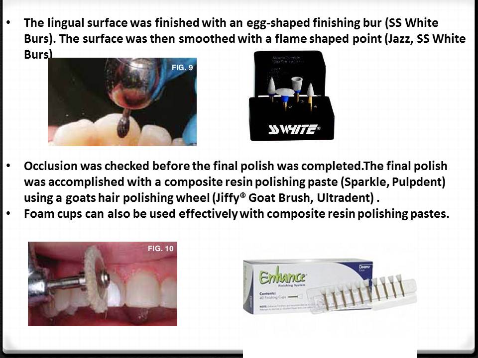 DOs and DONTs in DENTISTRY Polishing Composite Restorations EASY