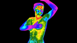 Thermography to Assess Breast Inflammation in breast cancer survivors Thermography to Assess Breast Inflammation in breast cancer survivors