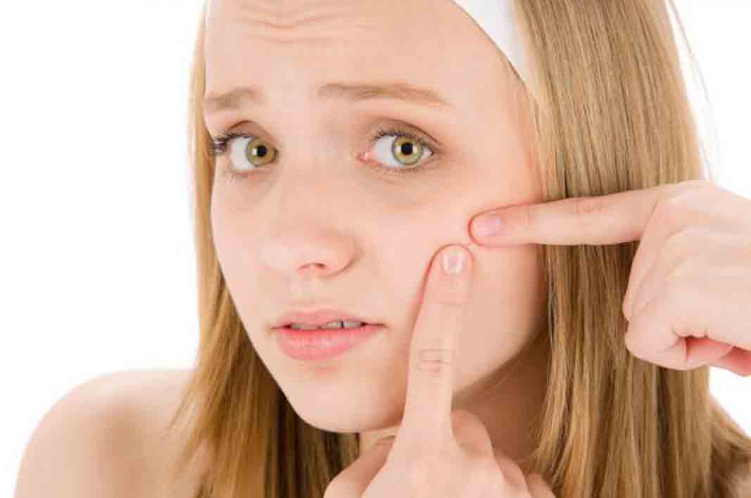 Do not Miss this. 10 Benefits of Lime for acne and scars kidbrooke