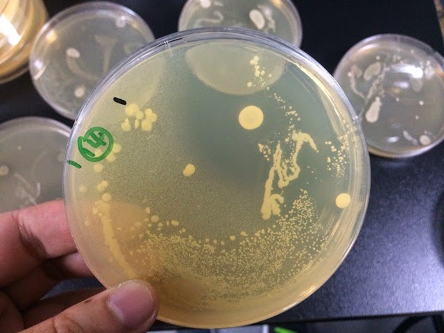 楊容的學習記錄: 0513抑菌實驗結果