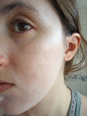 beautypul, adapalene, adapaleno, mi experiencia, retinal, retinol, retinyl palmitate, tretinoin, tretinoina, vitamina A, 