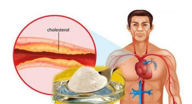 Wow Tak Perlu Mahal Ternyata 7 Bahan Alami Ini Ampuh Usir Kolesterol Selamanya Dalam Tubuh Anda Lho !!!