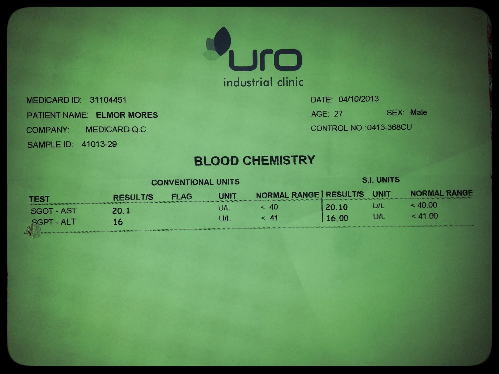 POTTERmoi BLOOD TEST RESULT ON LIVER ENZYMES