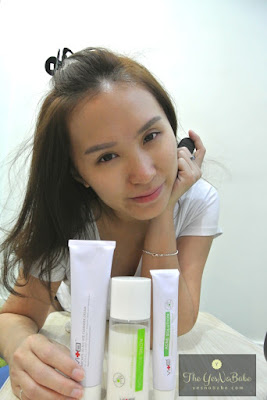A girl looking into camera showing off her Swissvita anti acne solutions