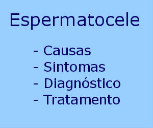 Espermatocele causas sintomas tratamento