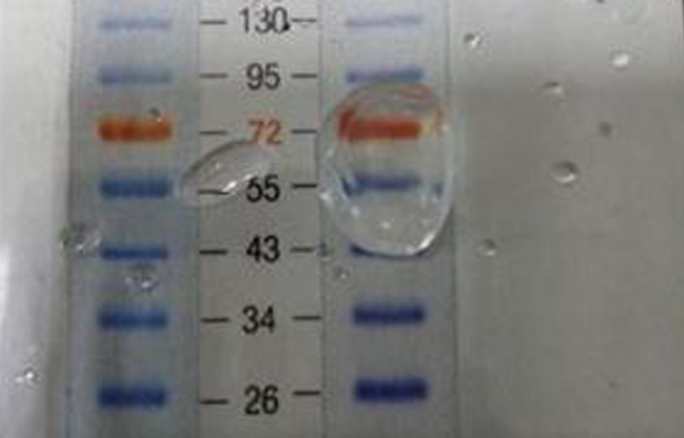 豬人工眼角膜　造福300萬名視障者