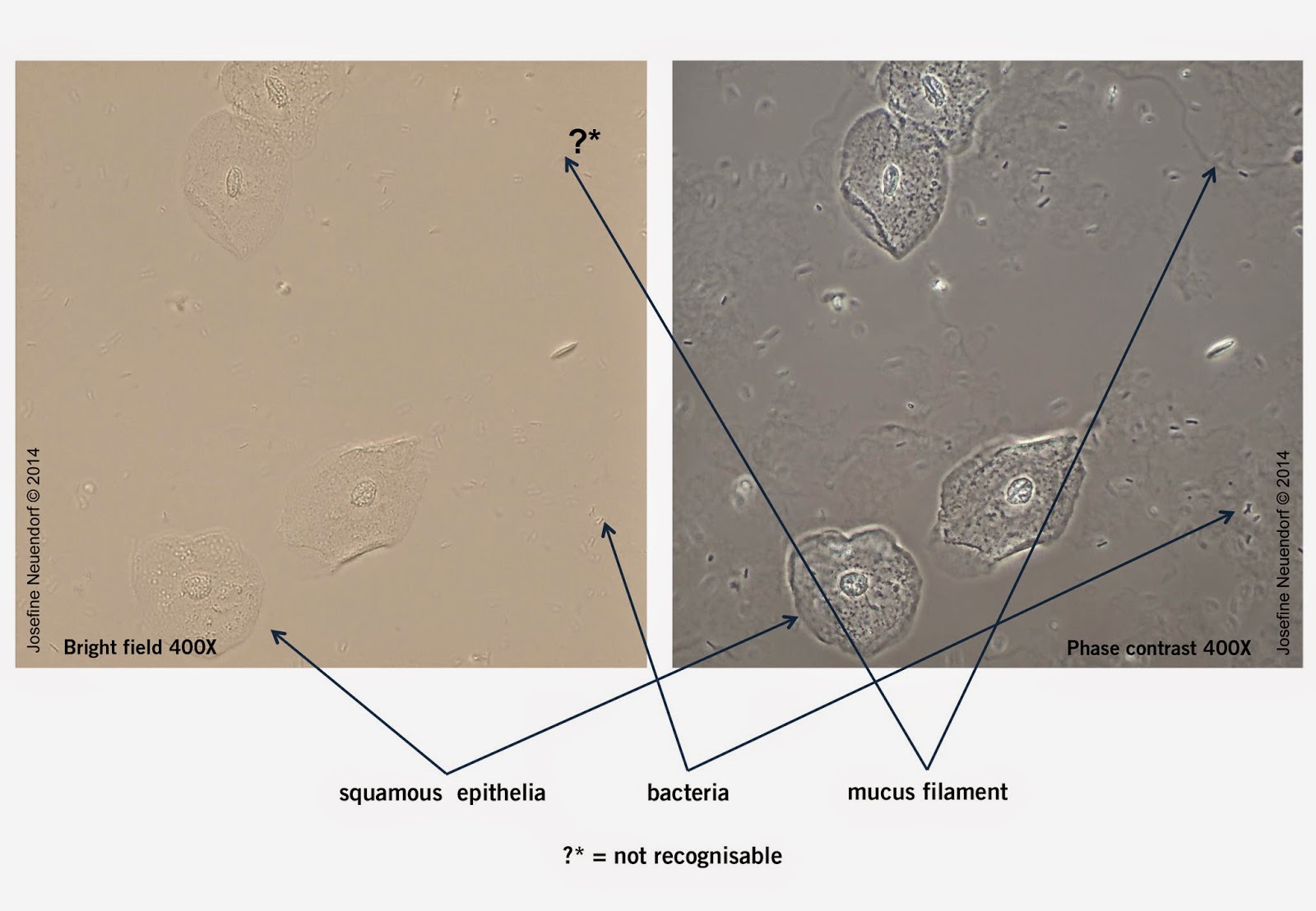 Motic Europe Blog Distinct differentiation of urine sediments