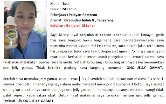 Cara Menyembuhkan Benjolan Di Belakang Lutut Tanpa Operasi Cara Menyembuhkan Benjolan Di Belakang Lutut Tanpa Operasi