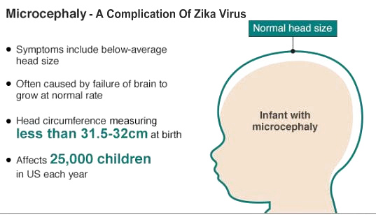 Zika Virus Complications