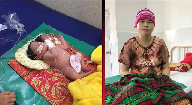 Lahir Bayi Kembali Dengan 2 Kepala Kondisinya Normal, Namun Kasihan Orang Tuanya Lahir Bayi Kembali Dengan 2 Kepala Kondisinya Normal, Namun Kasihan Orang Tuanya