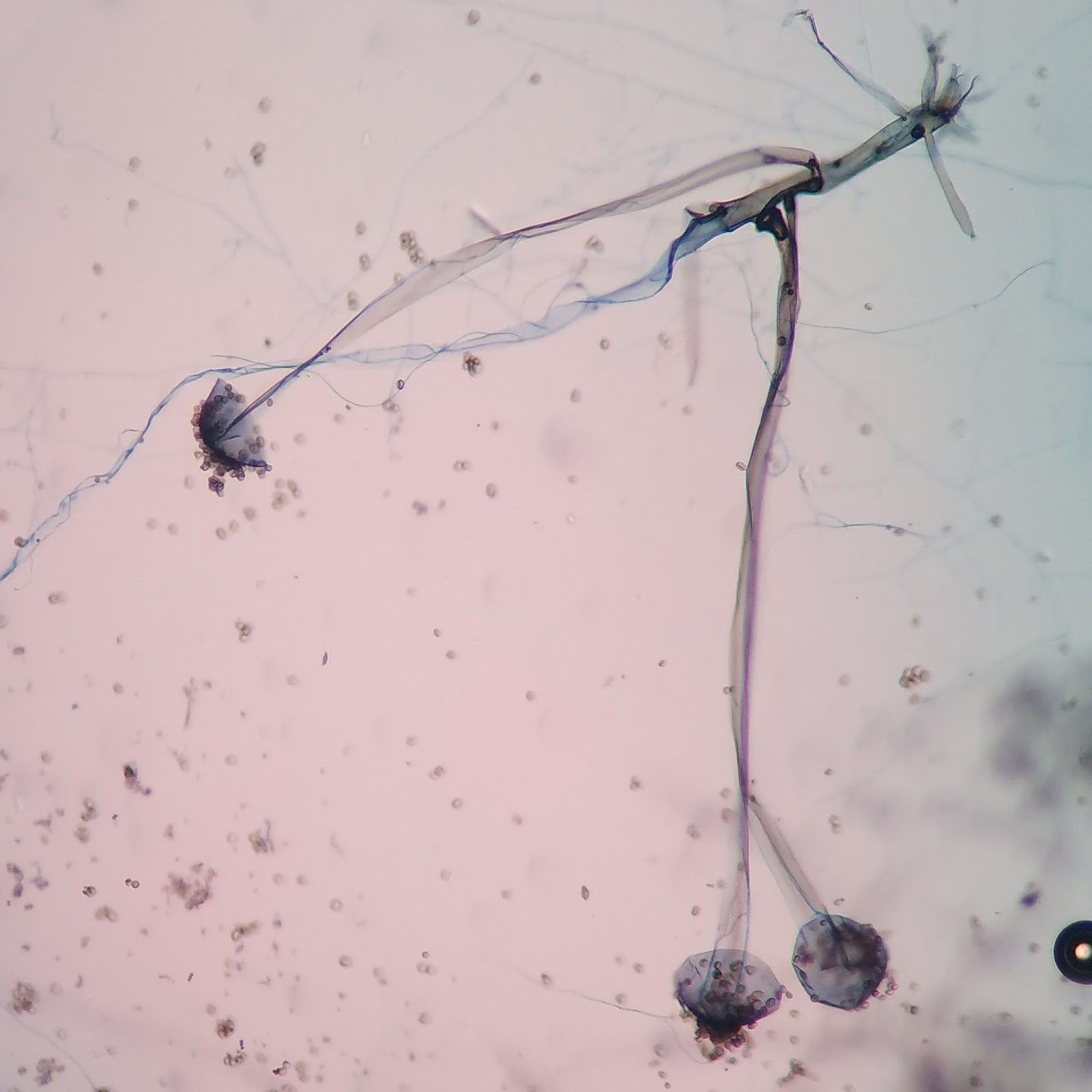 Мукор обыкновенный. Мукор ризопус. Rhizopus oryzae. Плесень ризопус (Rhizopus oligosporus). Rhizopus 40x под микроскопом.