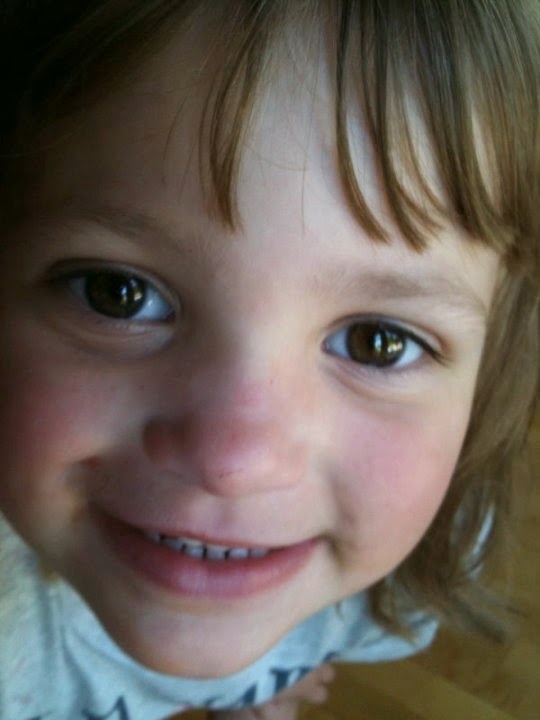 Mastocytosis A Rare Disease Mastocytosis Flare Pictures