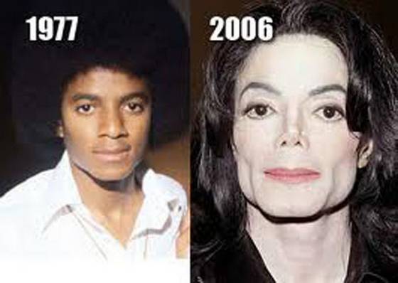 Michael Jackson Plastic Surgery Before and After Nose Jobs 