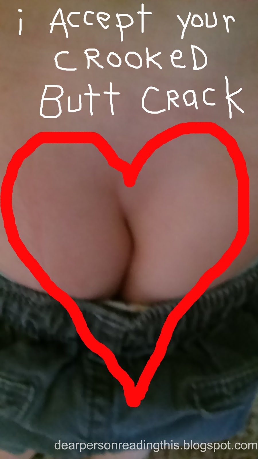 Crooked buttcrack