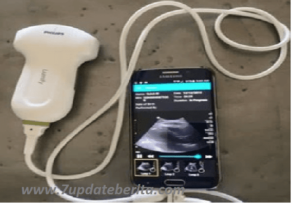 Kabar Gembira Untuk Para Ibu Dan Juga Isteri,…Cek USG Bisa Lewat Android SmartPhone ,Tak Perlu Ke Dokter Atau Ke Rumah Sakit !! Begini Caranya,..?!!!