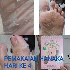 Jual Hanaka Baby Foot Mask Pemutih Kulit Kaki 085878187555 Murah Jakarta Surabaya Images_016