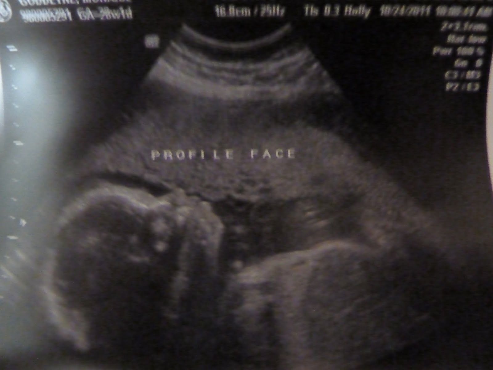 Domestic Manifesto: Third Trimester - Best Dr's Appt Ever