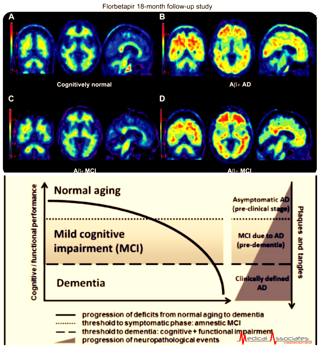 Medical Associates : Mild Cognitive Impairment risk factors you should ...